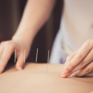 How does acupuncture work?