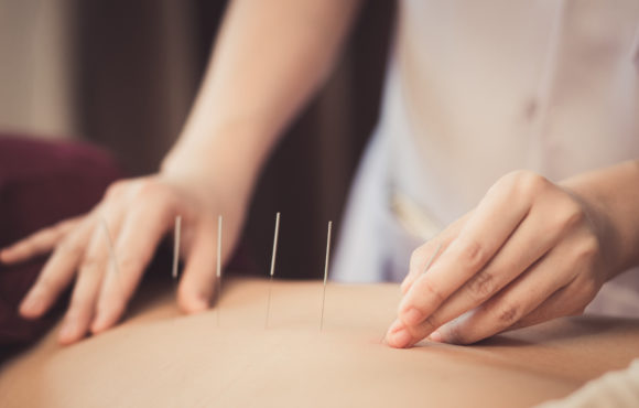 How does acupuncture work?